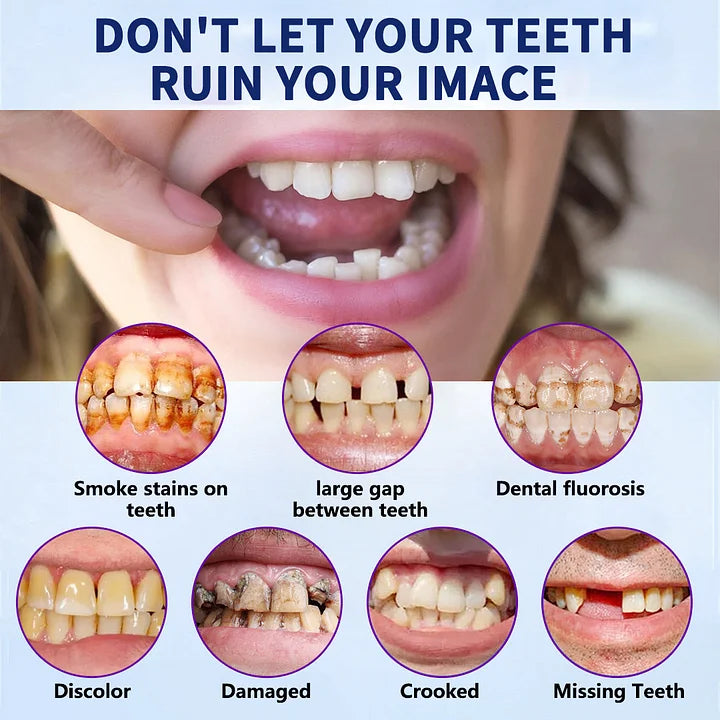 SmileFitPro – PRossoesi dentale flessibile di nuova generazione