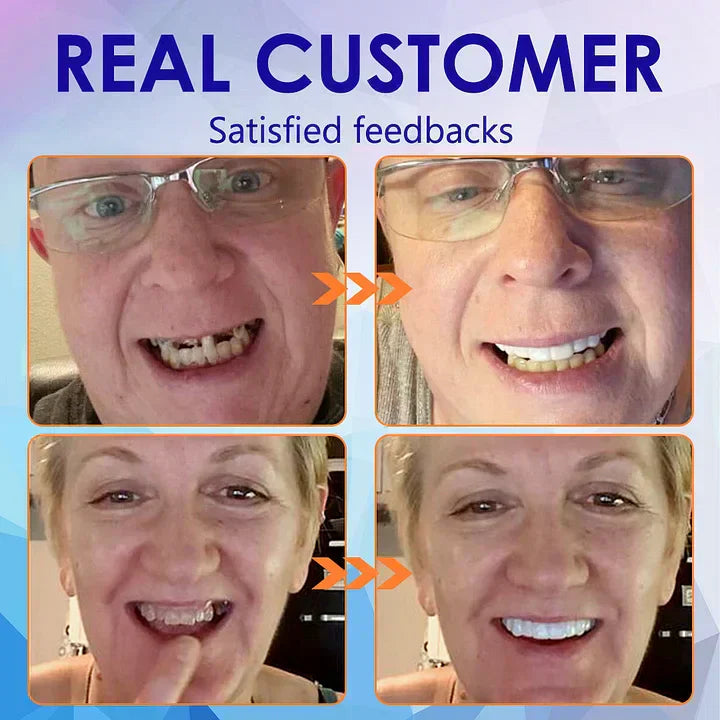 SmileFitPro – PRossoesi dentale flessibile di nuova generazione
