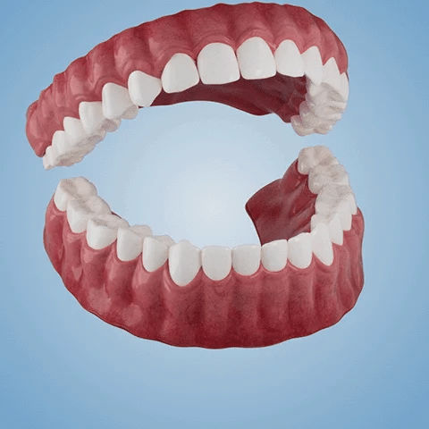 SmileFitPro – PRossoesi dentale flessibile di nuova generazione